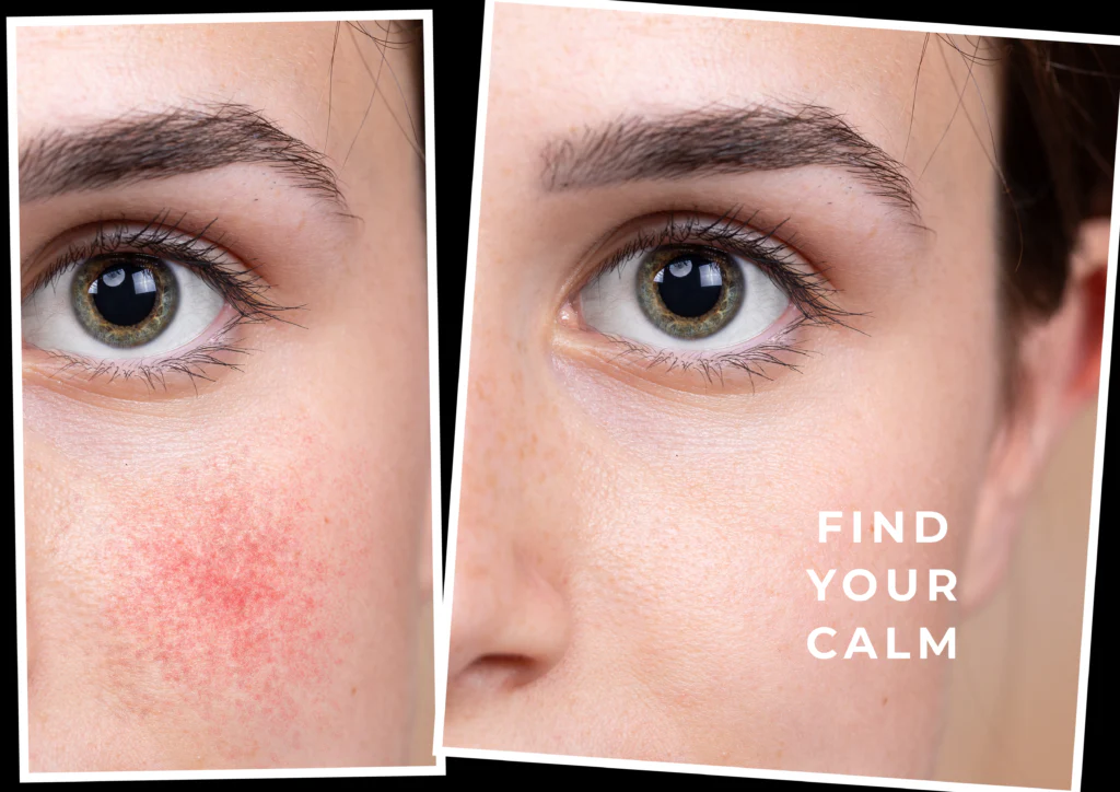 CV Skinlabs Calming Moisture for Face, Neck and Scalp - Image 5