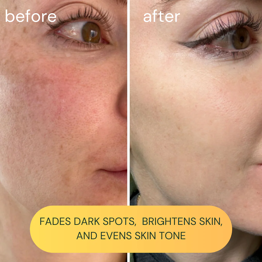 Koa Life Vit-C Brightening Oil - Image 6