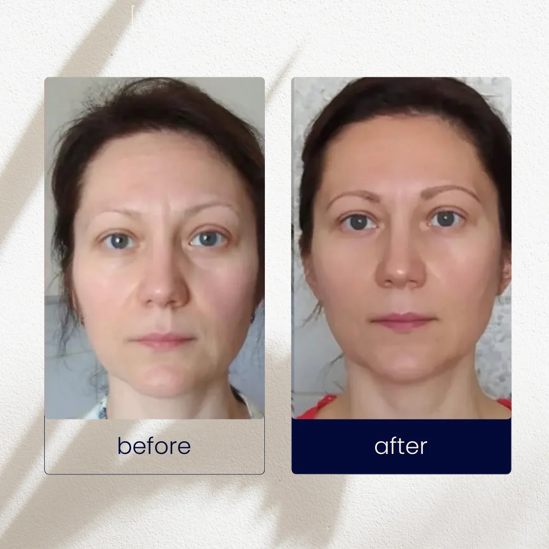 Pari Satiss Rosewater Firming Toner - Image 4